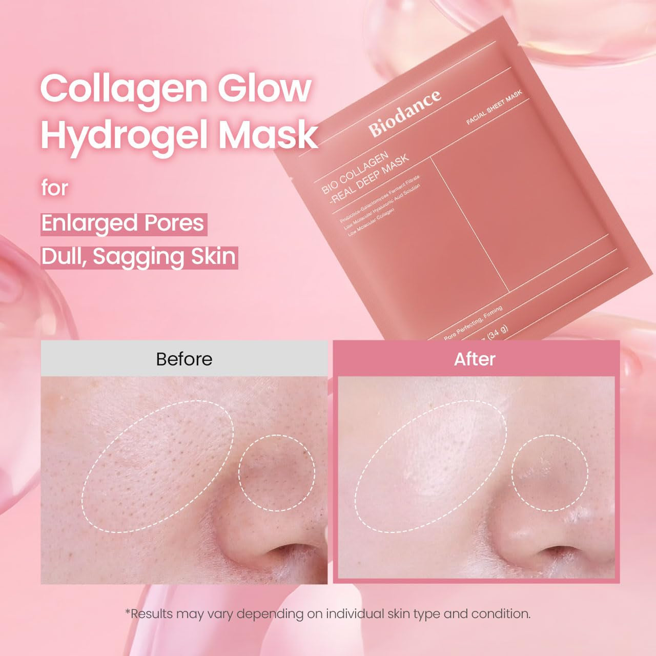 Bio-Collagen Real Deep Mask, Hydrating Overnight Hydrogel Face Mask, Pore Minimizing, Elasticity, Plumping, after Sun Care, Travel Essentials for Women, Korean Skin Care | 1.19Oz(34G) X 4Ea