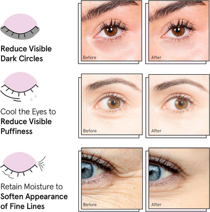 Award Winning under Eye Mask - Birthday Gifts for Women - Gel Eye Patches for Dark Circles, Puffy Eyes, Undereye Bags - Gifts for Mom - Travel Essentials - Vegan (24 Pairs, Gold)